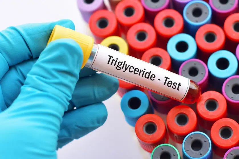 triglicerīdi